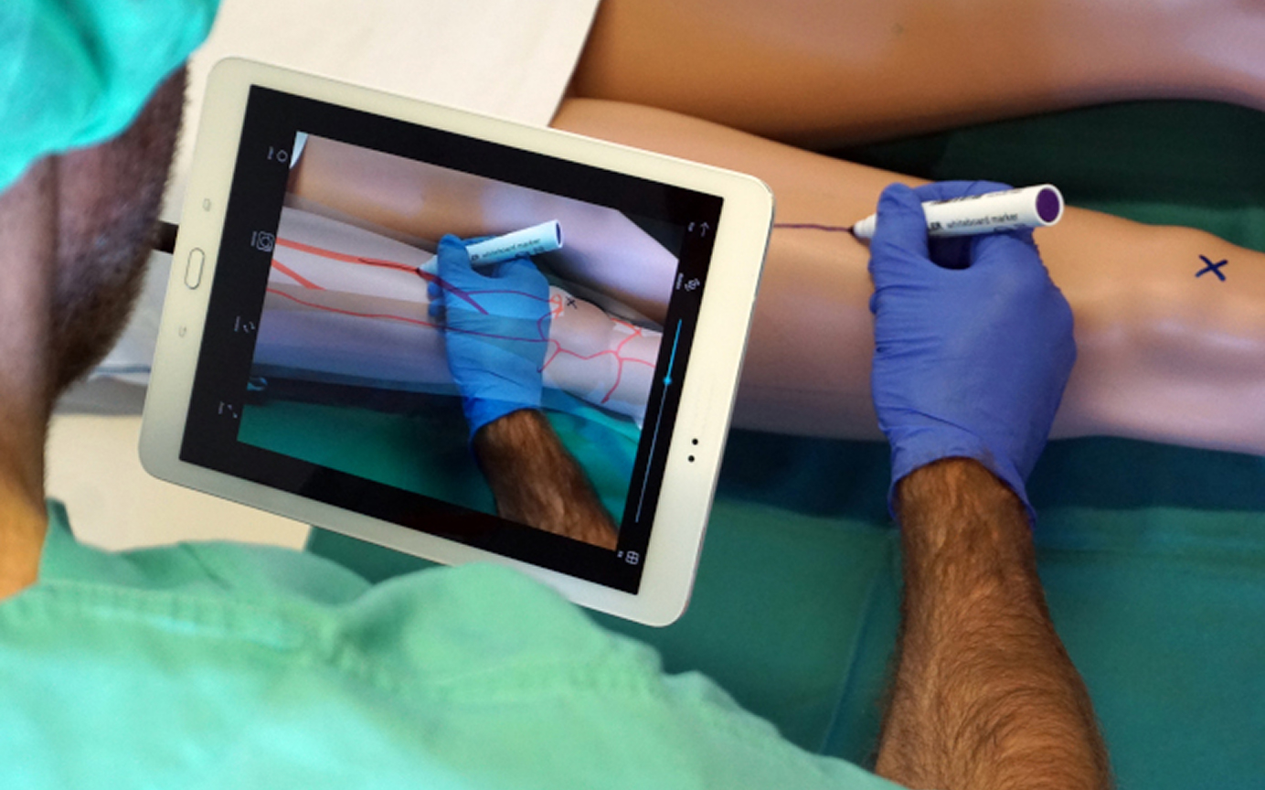 Medizinisches Training mit Augmented Reality – Tablet zeigt virtuelle Blutgefäße auf einem Modellbein.